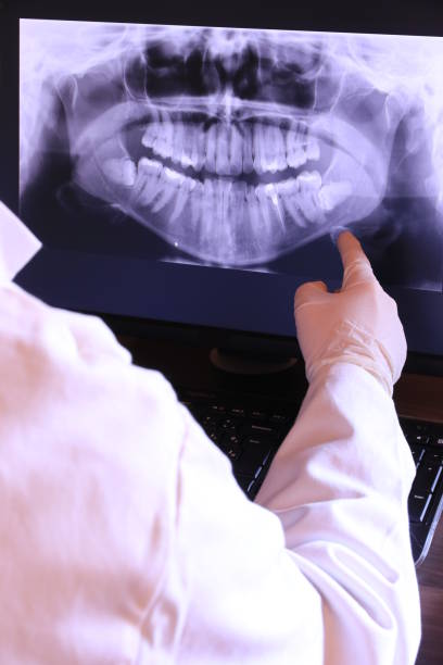 Best Knocked-Out Tooth (Avulsed Tooth) Treatment in Sleepy Hollow Lake, NY